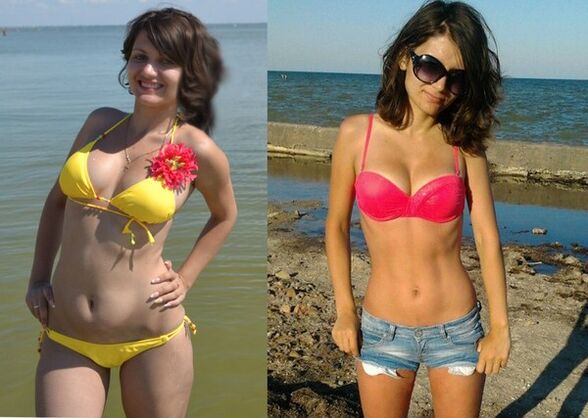 Anna lost 10 kg with NexaSlim
